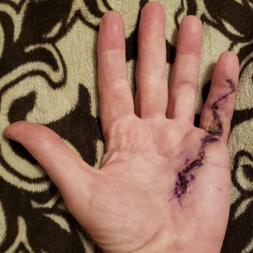 The Gnaw Hand Of Franklinos