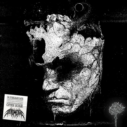 Dead Weight - Open Sore