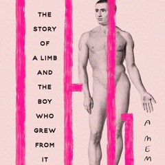 free read✔ Leg: The Story of a Limb and the Boy Who Grew from It