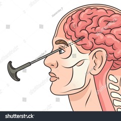 KETAMIR - Neurotoxina
