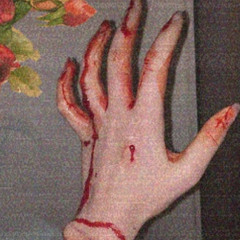 urbleeding:( (AT2035)