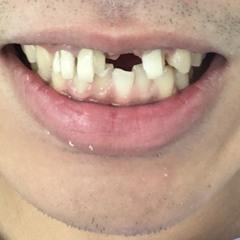 What you. gonna do.mp3