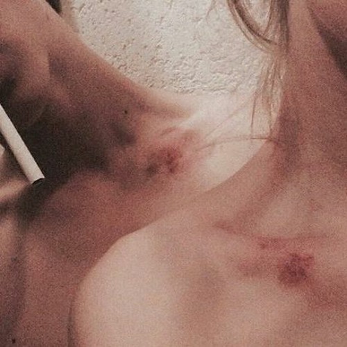 Hickeys (Feat.Rose De Penny)