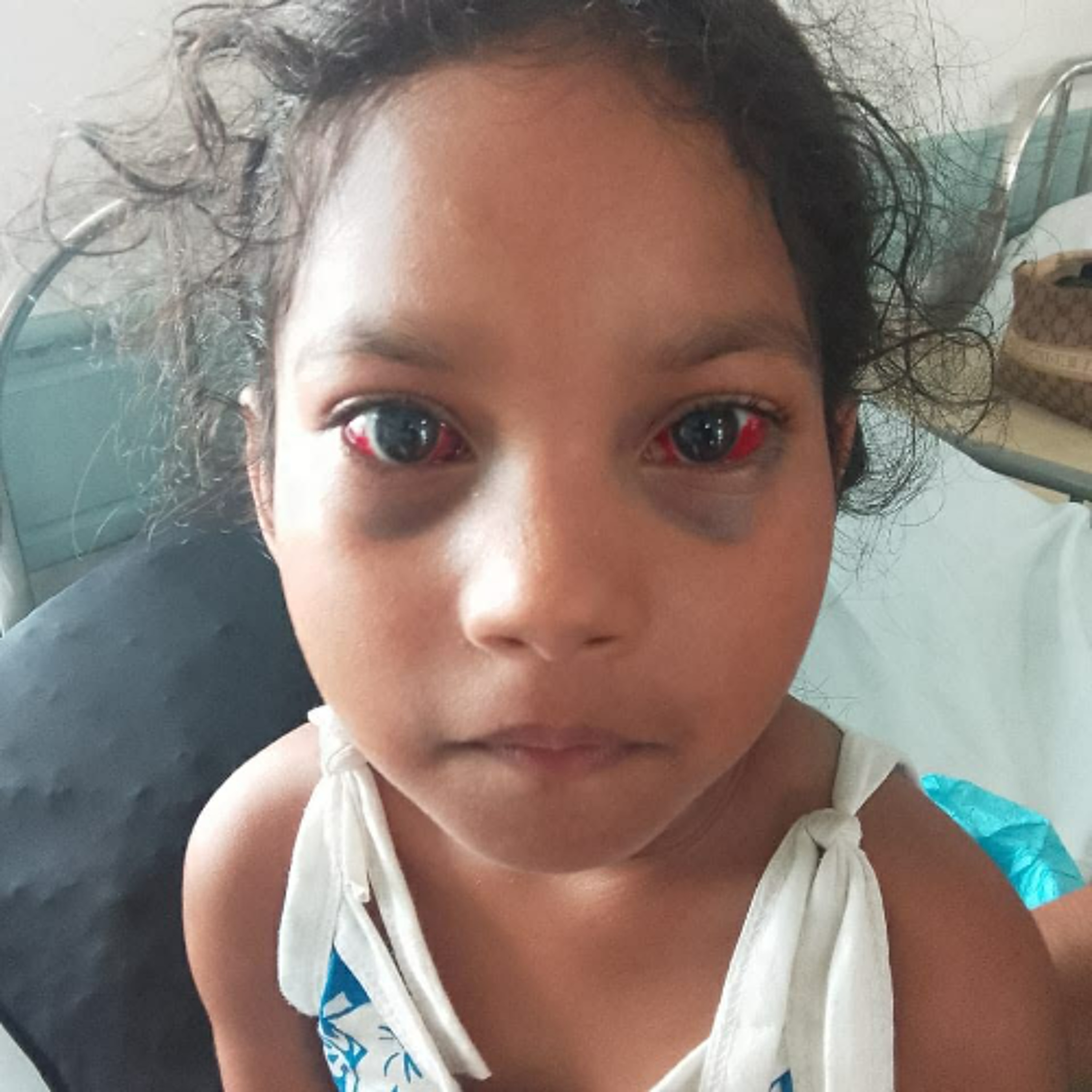 Barkly : Lucia, 6 ans, agressée à son domicile…« Li ankor traumatisée, li pa kav dormi asoir », déplore son père