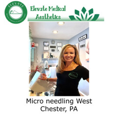 Micro needling West Chester, PA