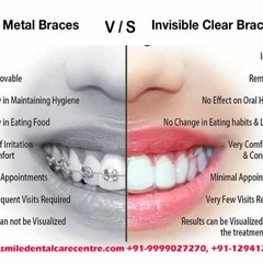 Orthodontic Dental Clinic Offering Best Braces Treatment in Faridabad