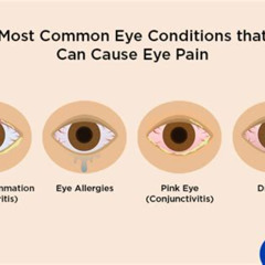 Best Eye Pain After Waking Up Treatment Reviews