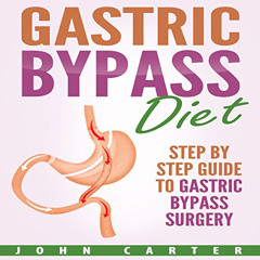 ACCESS KINDLE 💜 Gastric Bypass Diet: Step by Step Guide to Gastric Bypass Surgery by
