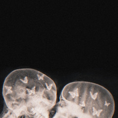 Uwa Metekitek (Micklow) Slowed+Reverb