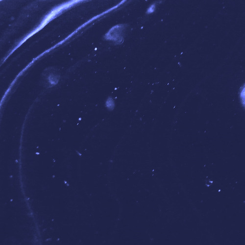 Sometimes, I forget to...