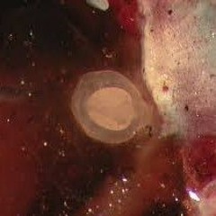 Parasite