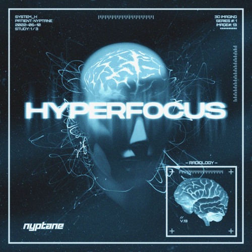 Hyperfocus (Free Download)