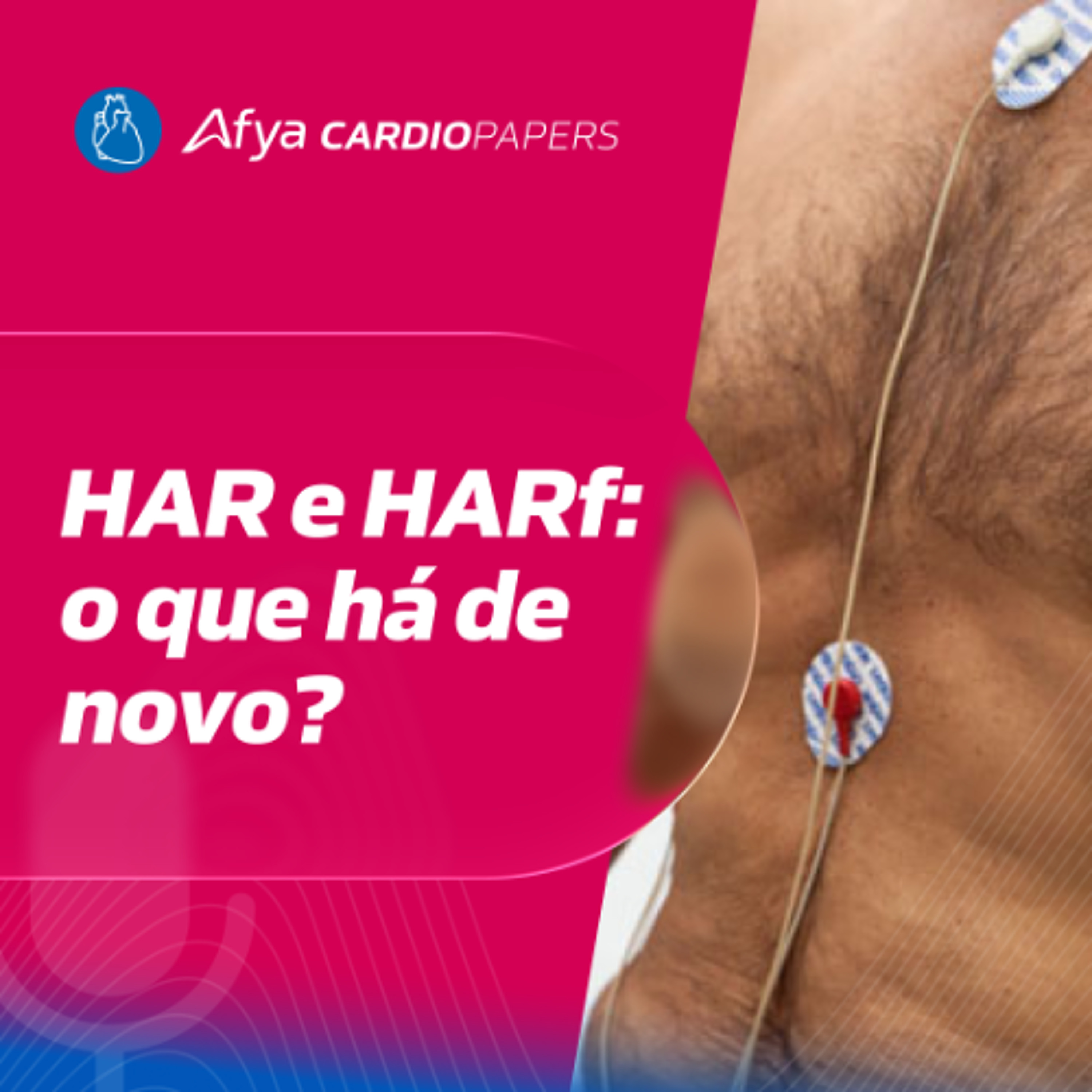 Hipertensão Arterial Resistente e Refratária: Como Identificar?