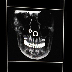 Swallowed Whole (God's Mouth)