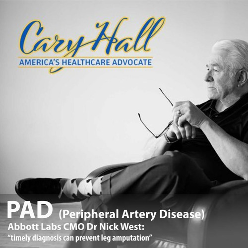 Abbott CMO Dr West discusses PAD & how timely diagnosis can prevent leg amputation