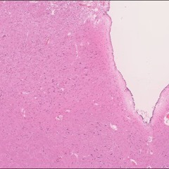 Medulla //stati aggettivi.