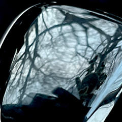 Clarity in Obscuration