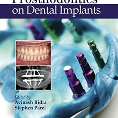 [Read] [EBOOK EPUB KINDLE PDF] Journal of Prosthodontics on Dental Implants by  Avinash Bidra &  Ste