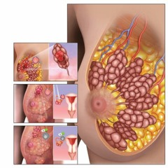 The Role of HER2 Mutant Alleles in Breast Cancer