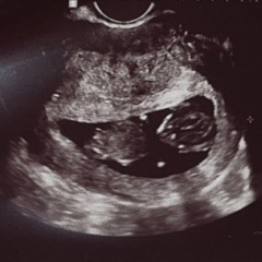 someday never comes (prod. arcane beats)