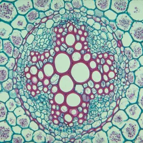 Dense Tissue