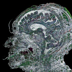 How To Lobotomise Friends and Trepan People