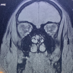 Mezzi Morti-Suffer Well.WAV