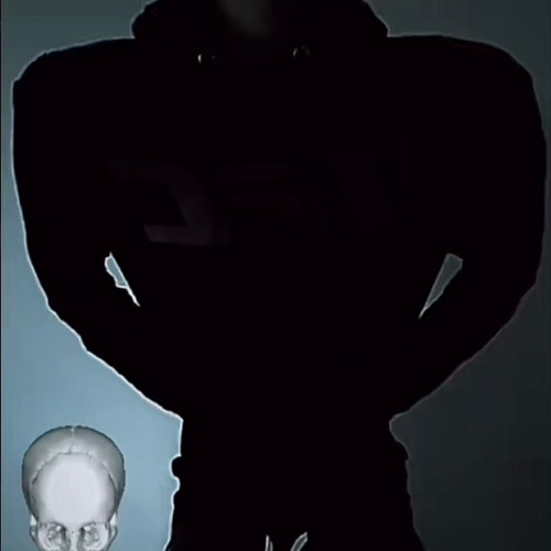 framepill