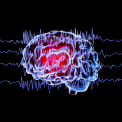 Fabio Zammarchi - EPILEPTIC SEIZURES