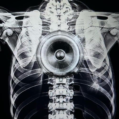 Plz Turn Dat Down (d1sgrace + ogkush420)