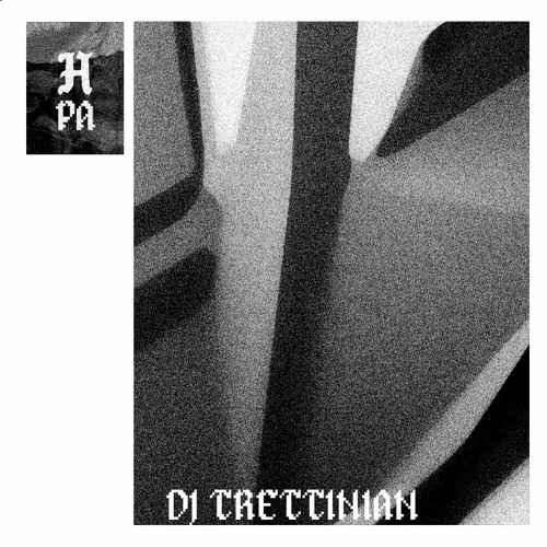 Huldra PA #6 - DJ Trettinian
