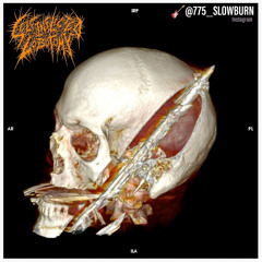 mangled cadaver lying on the pavement after falling 8 stories from the murder suicide of his 2ndwife