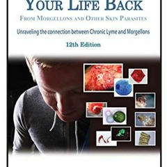 VIEW EPUB KINDLE PDF EBOOK How to Get Your Life Back From Chronic Lyme, Morgellons an