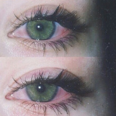 No Contacts