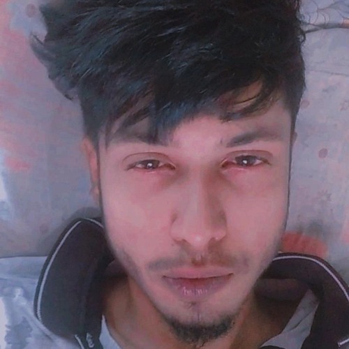 A$AP DIP - CONDZILO OFFICIAL AUDIO CENSORED