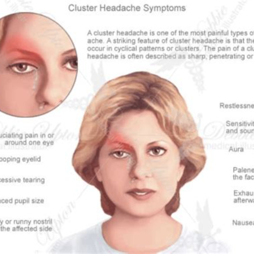 Best Headache Behind Left Eye Treatment Reviews