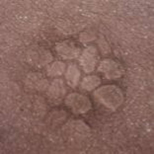 Mues stigmates d'une carapace