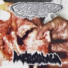 Fetal Deformity / Metrorrhagia Split 7" [Full Album