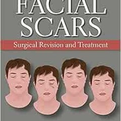 View PDF Facial Scars: Surgical Revision and Treatment by J. Regan Thomas,David B. Hom