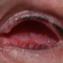 Belborn - Weint Keine Träne