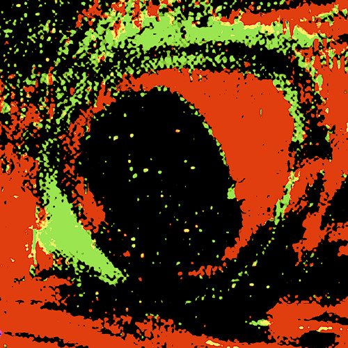 Quahogox Erectsip
