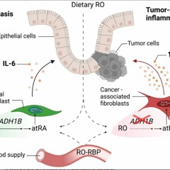 Retinol Disruption and The Role of Vitamin A Metabolism in Colon Cancer