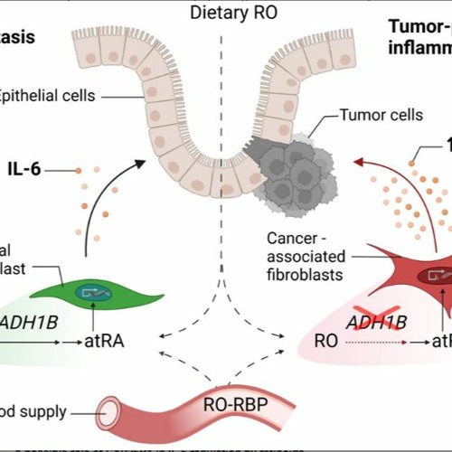 Retinol Disruption and The Role of Vitamin A Metabolism in Colon Cancer