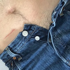 TRAUMA