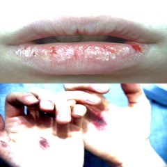 narna - L&H (444jet)