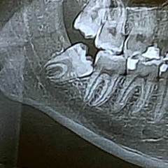 Hell On Earth 2020 (B2B - Ax & Zillion)