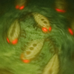 Brain Attack