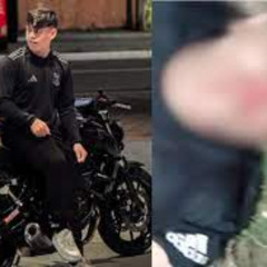 Portal Zacarias acidente de moto MT-07 sem cortes