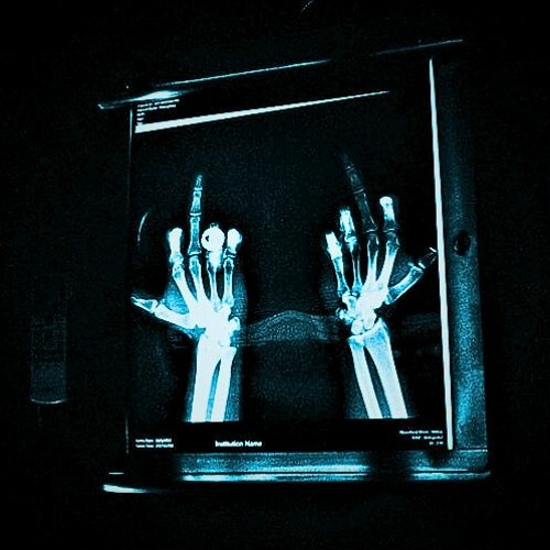 vowl. - lies (AENEAS Remix)