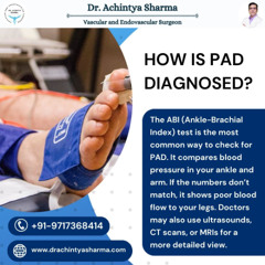 Top PAD Treatments in 2025 and Why Early Diagnosis Helps